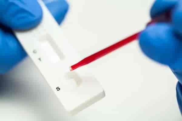 C Reactive Protein (CRP) Test