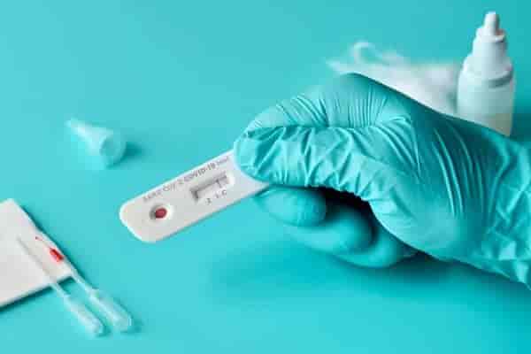C Reactive Protein (CRP) Test