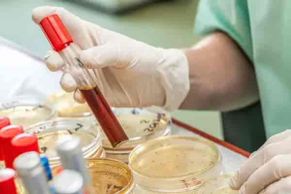 CSF JEV PCR (L) Test for Men & Women