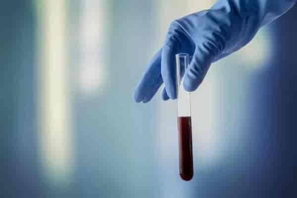 Human Parechovirus Qualitative PCR CSF (L) Test for Men & Women