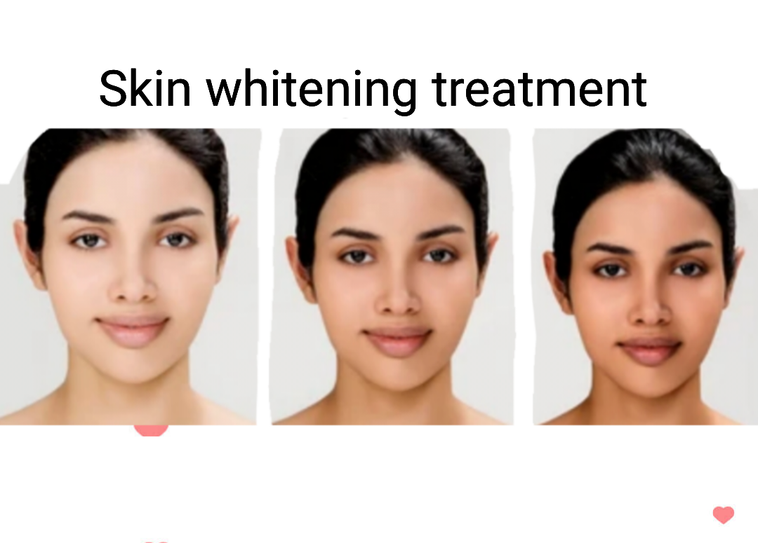 Skin Whitening Injection Price Starting From Rs 8/Pc. Find Verified Sellers in Chandigarh - JdMart Skin Whitening Injection Price Starting From Rs 8/Pc. Find Verified Sellers in Chandigarh - JdMart