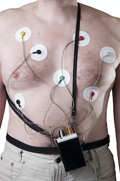 Holter ECG at Home in Bangalore