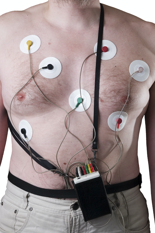 Holter ECG at Home in Bangalore