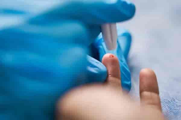 Malaria Test