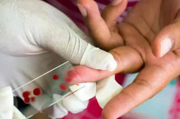 Malaria Test
