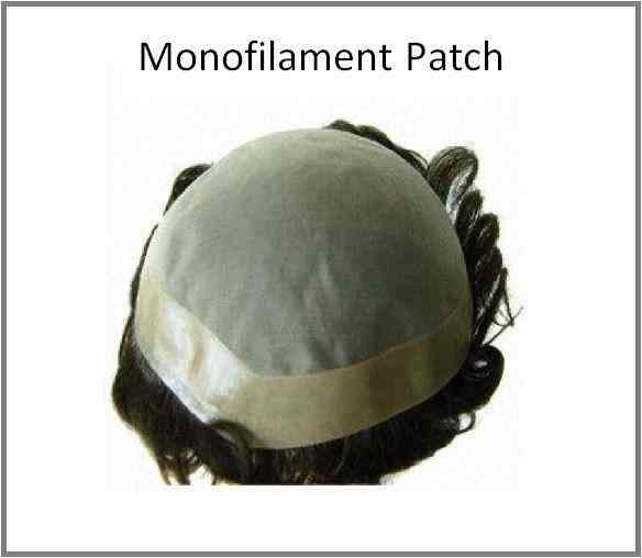 Toupee hernia repair sales