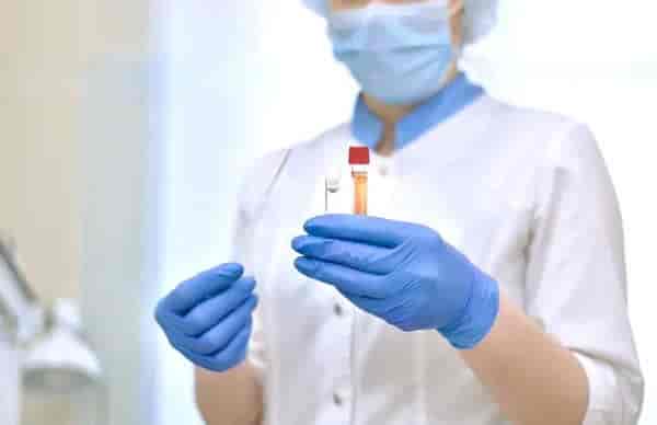 Plasma Fibrinogen Test