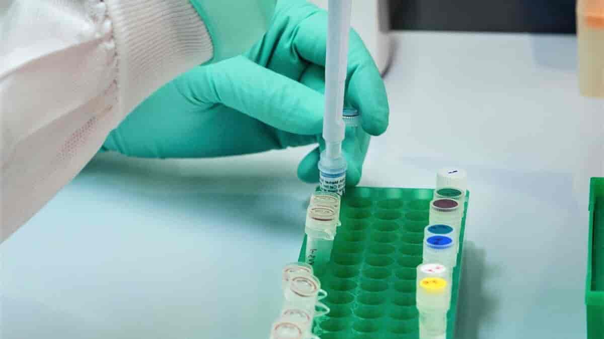 Stool Analysis Test
