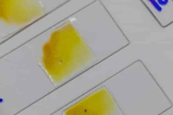 Stool Analysis Test