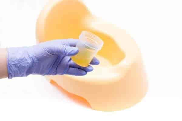 Stool Culture Test