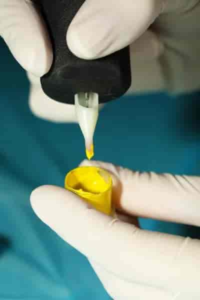 Stool Culture Test
