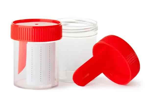 Stool Culture Test