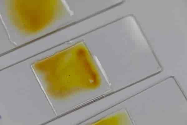 Stool Routine Test