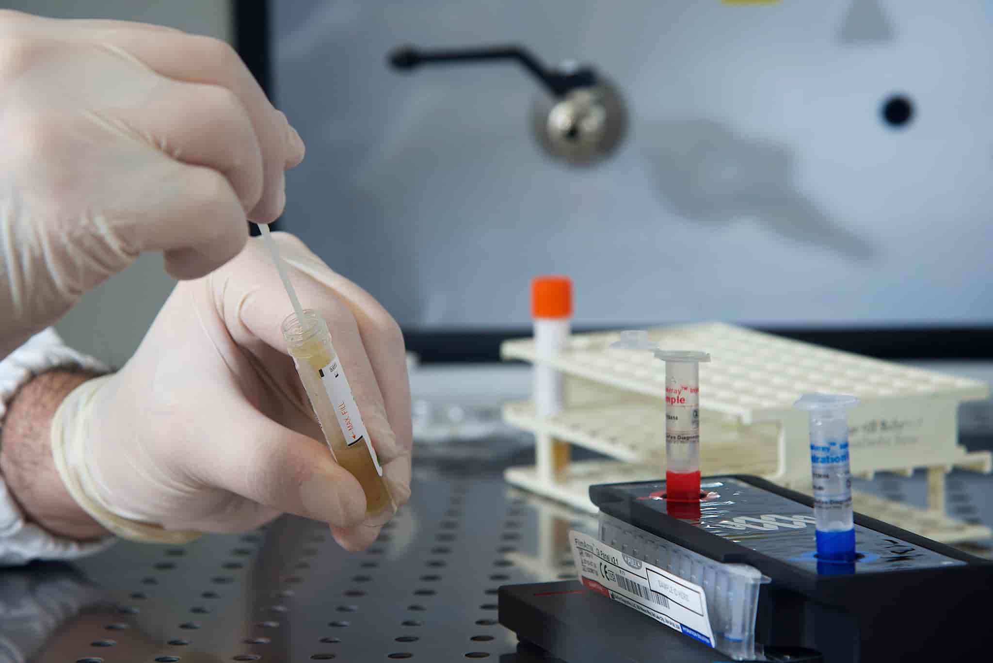 Stool pH Test