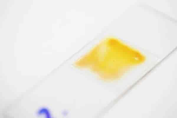 Stool pH Test