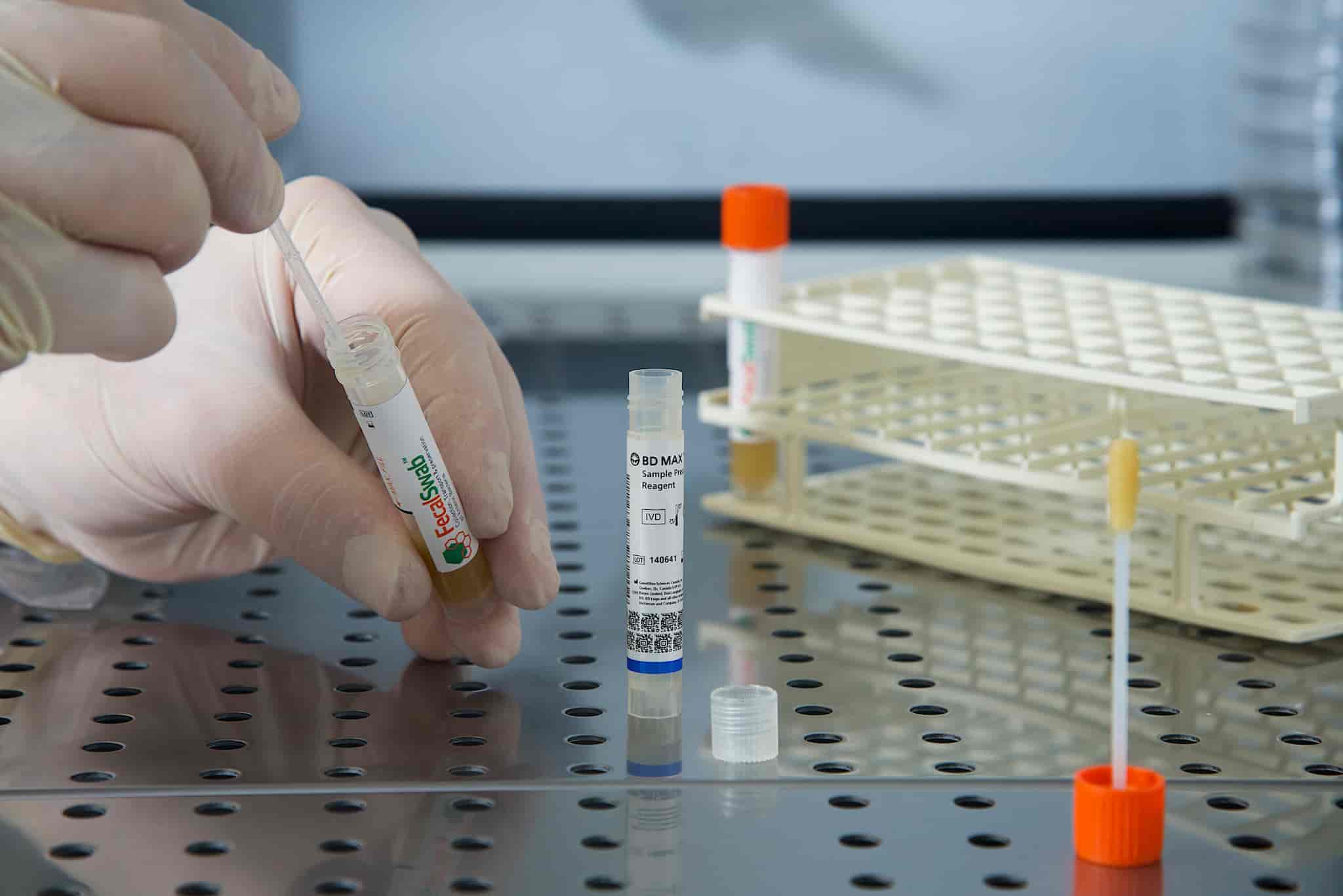 Stool pH Test