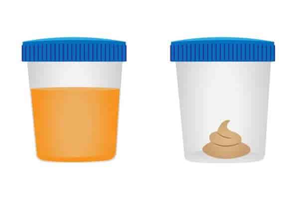 Stool pH Test