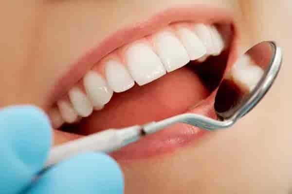 Teeth Cleaning