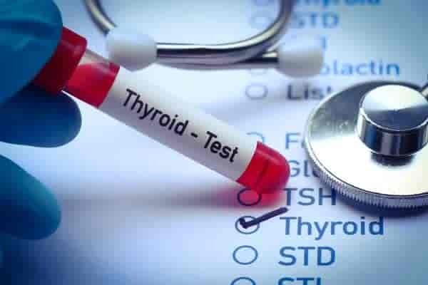 Thyroid Profile Test