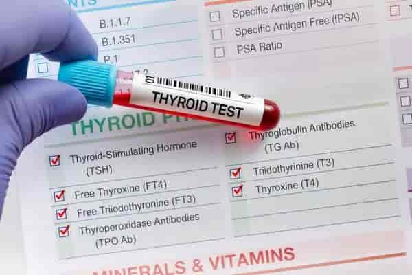 Thyroid Profile Test