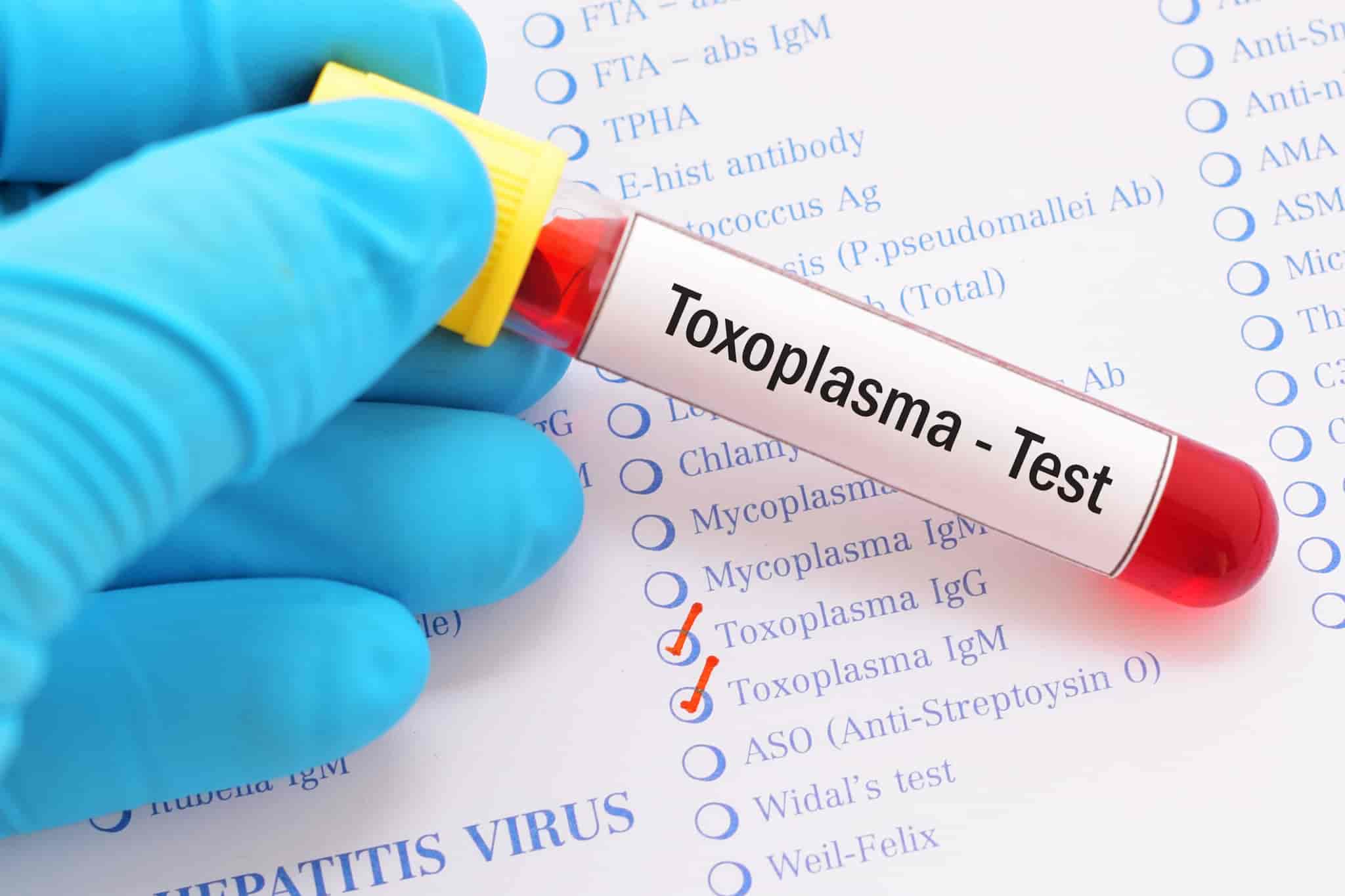 Toxoplasma (IgM) Test