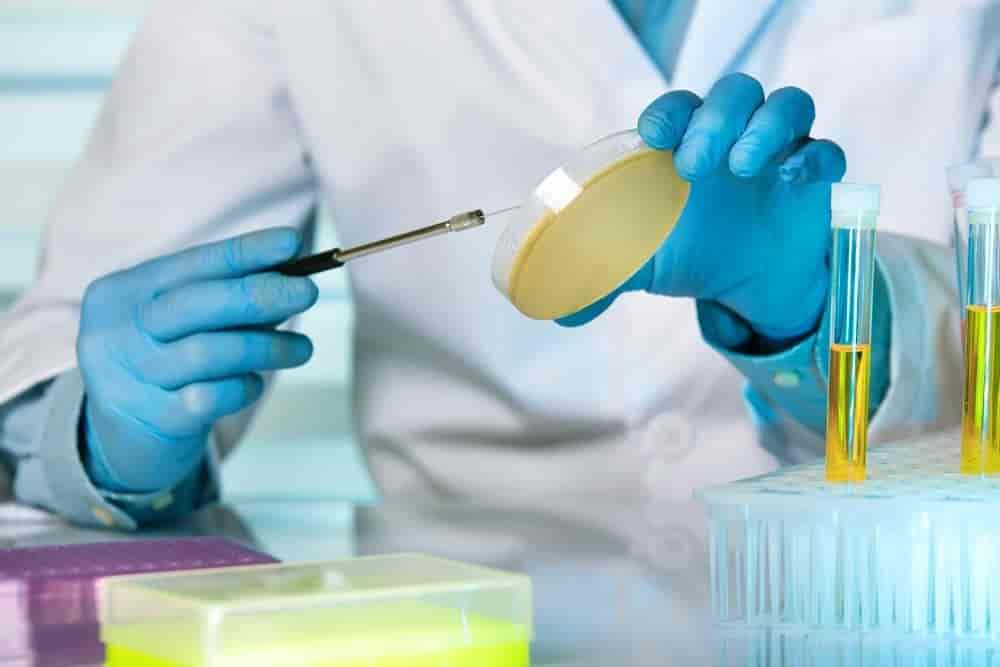 Urine Culture Test