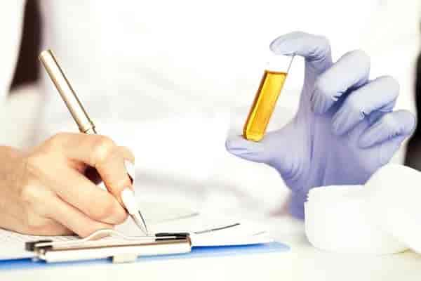 Urine Culture Test