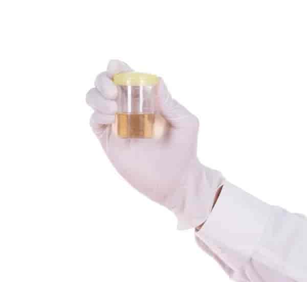Urine Culture Test