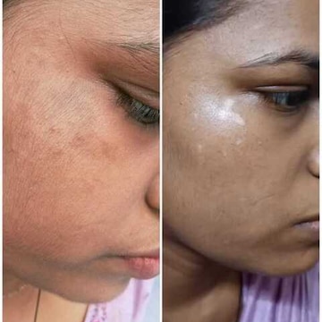 Top Dermatologists With Glutathione For Skin Whitening in Tanda, Tanda -  Best Dermatologists With Glutathione For Skin Whitening - 𝗕𝗼𝗼𝗸  𝗔𝗽𝗽𝗼𝗶𝗻𝘁𝗺𝗲𝗻𝘁 𝗢𝗻𝗹𝗶𝗻𝗲 near me