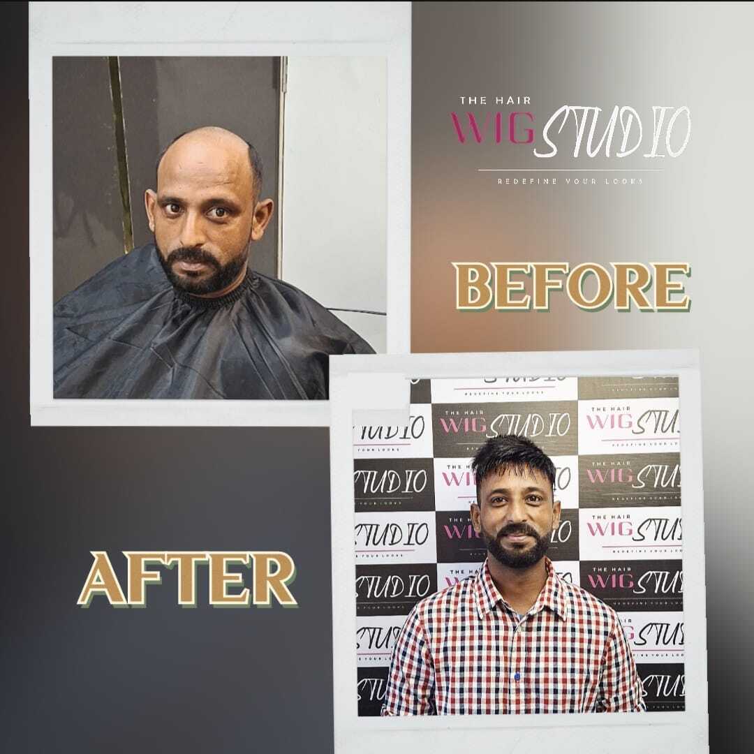 22 Photos of The Hair Wig Studio in Amritsar Colony Amritsar Justdial