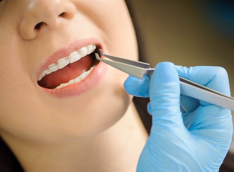 Smile Smart Dental in Electronic City,Bangalore - Best Dental Clinics in Bangalore - Justdial