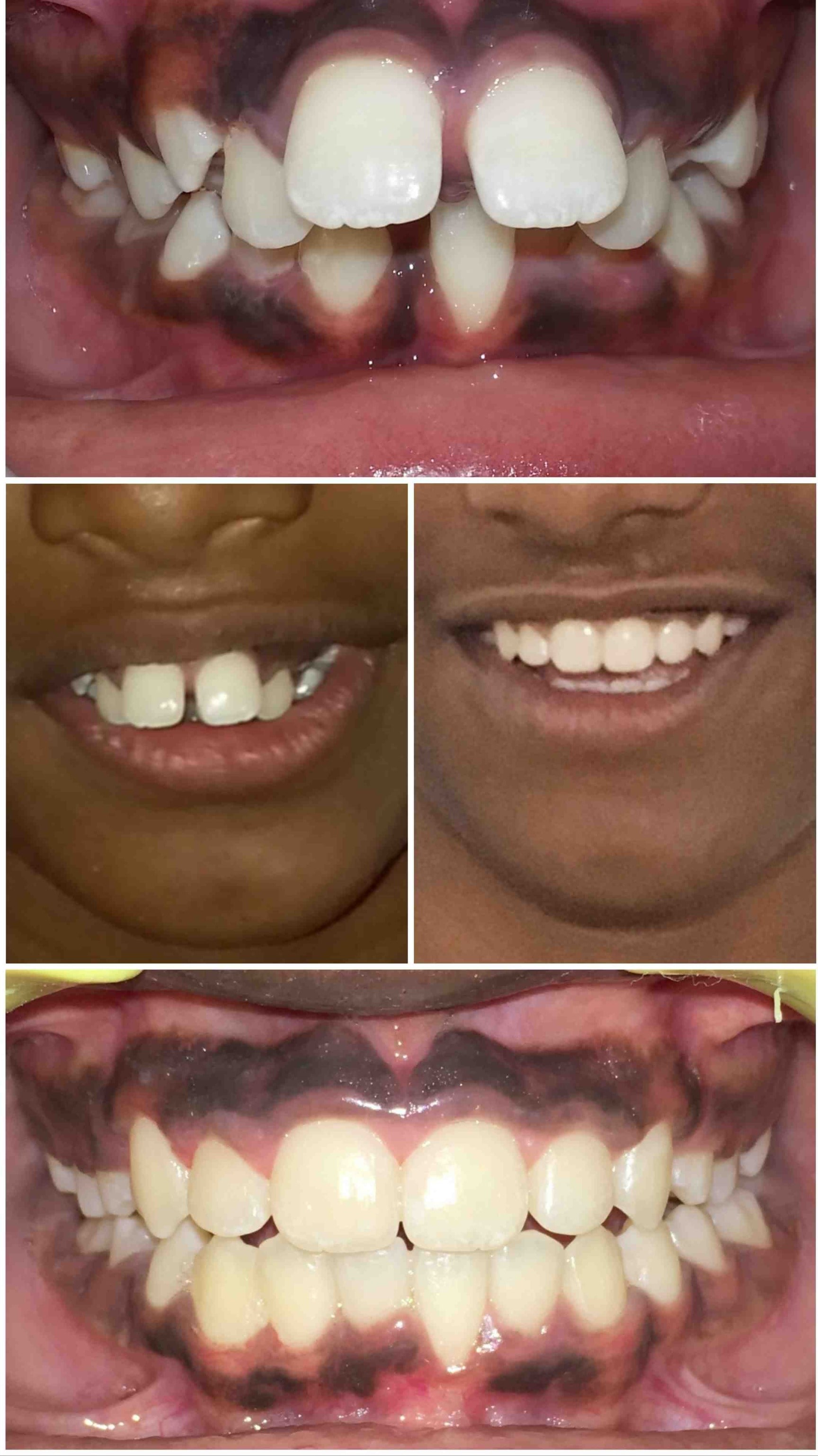 Sure Smile Dental Care in Banaswadi,Bangalore Best Dental Clinics in