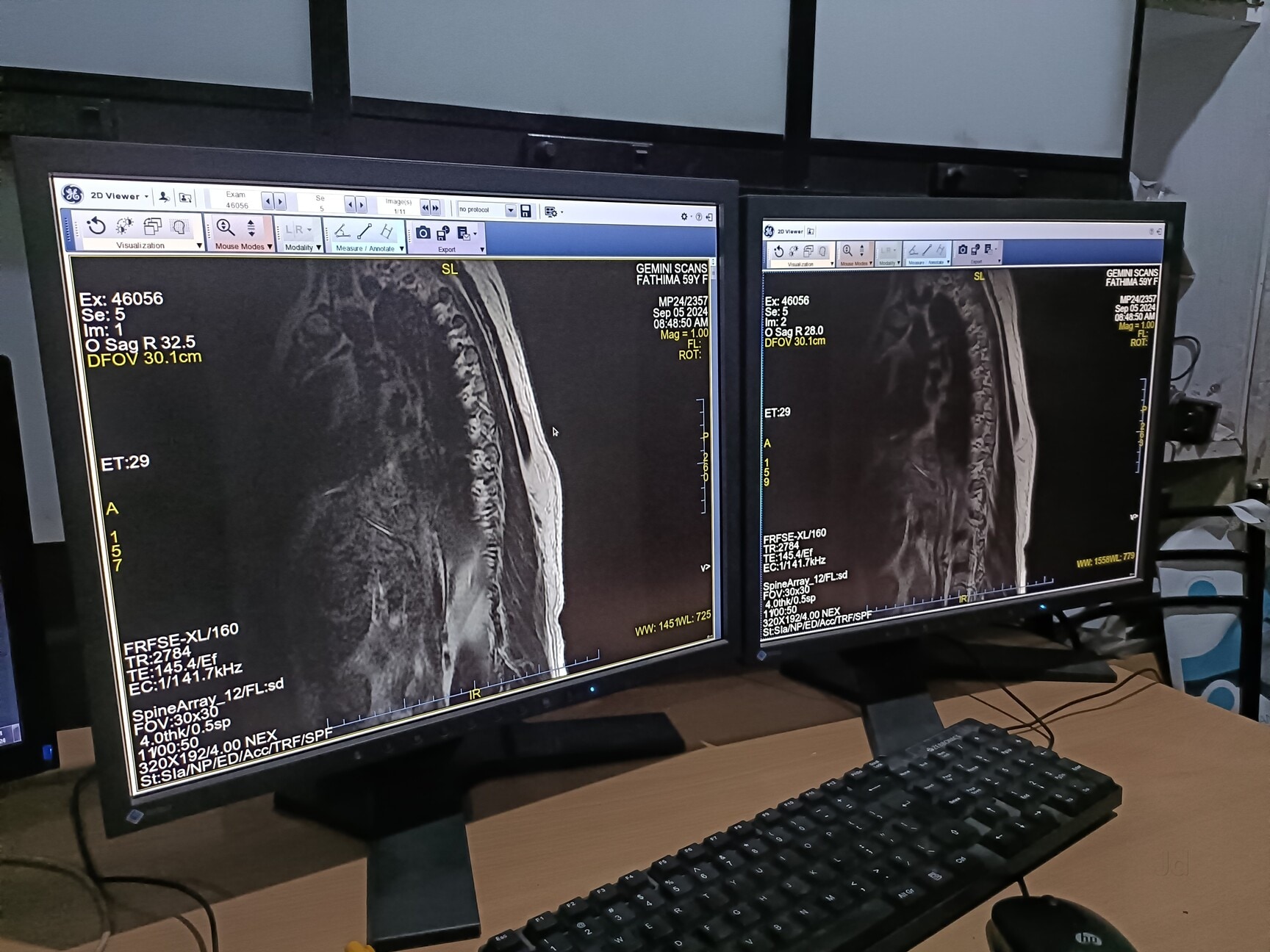 Lab view 17