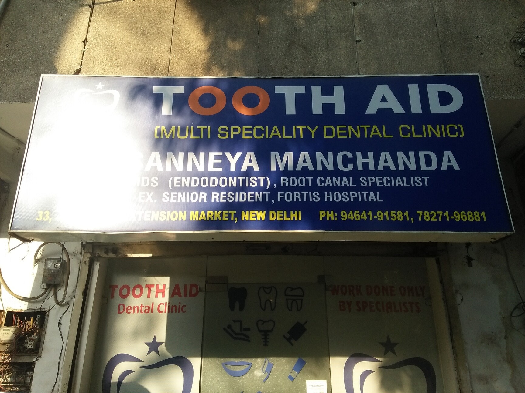 dental replacement - Pay Attentions To These 25 Signals