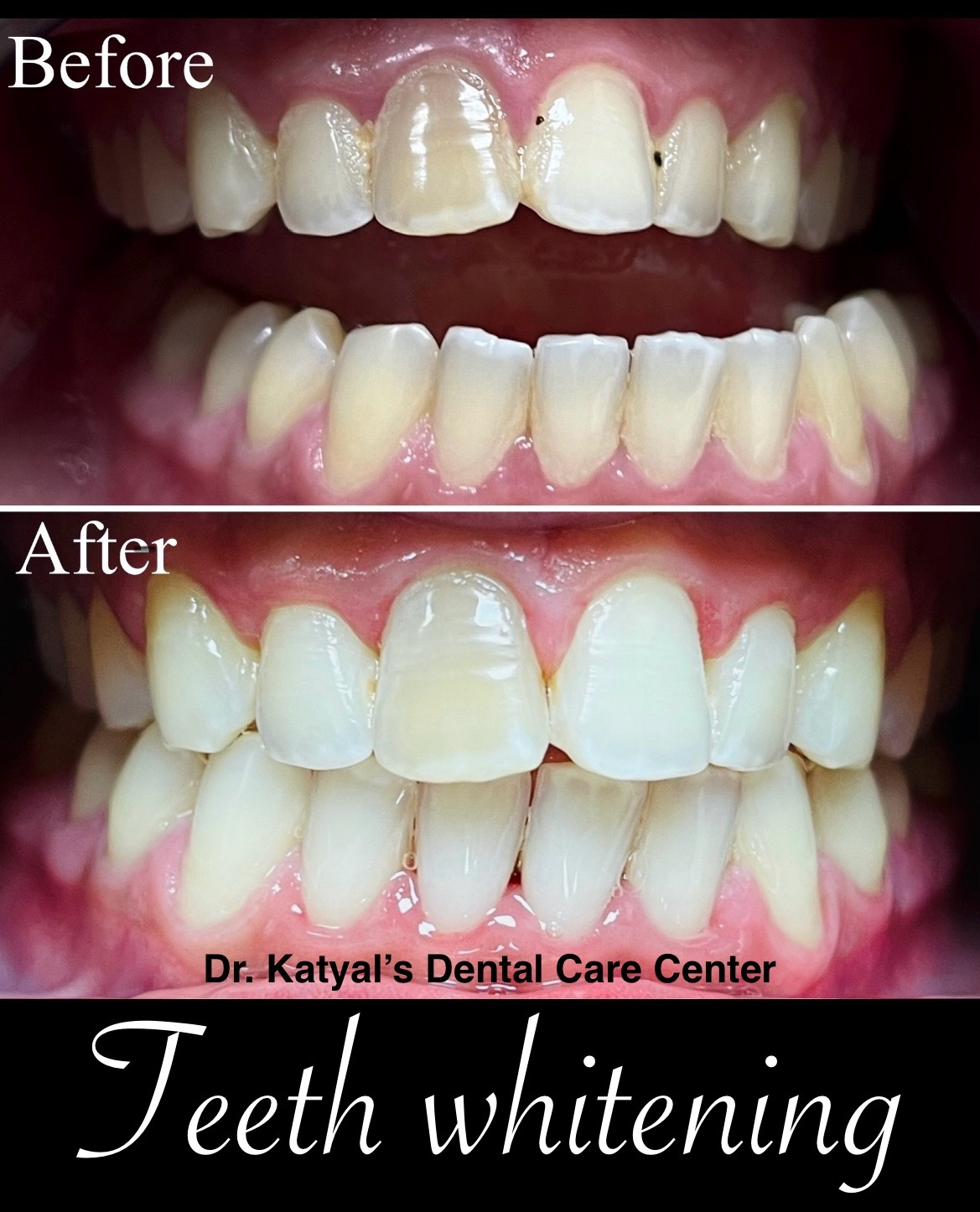 Dr. Katyals Dental Care Center in Nirman Vihar,Delhi Book Appointment