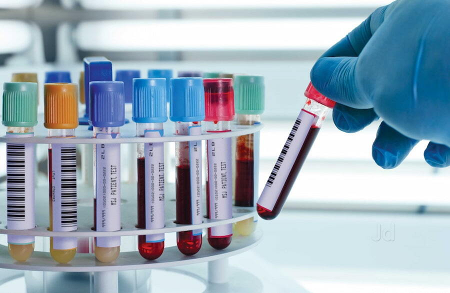 https://content.jdmagicbox.com/v2/comp/hyderabad/f5/040pxx40.xx40.221202202843.u9f5/catalogue/home-blood-sample-collection-services-labspark-diagnostics-hyderabad-blood-testing-centres-ca2u5pia1b.jpg