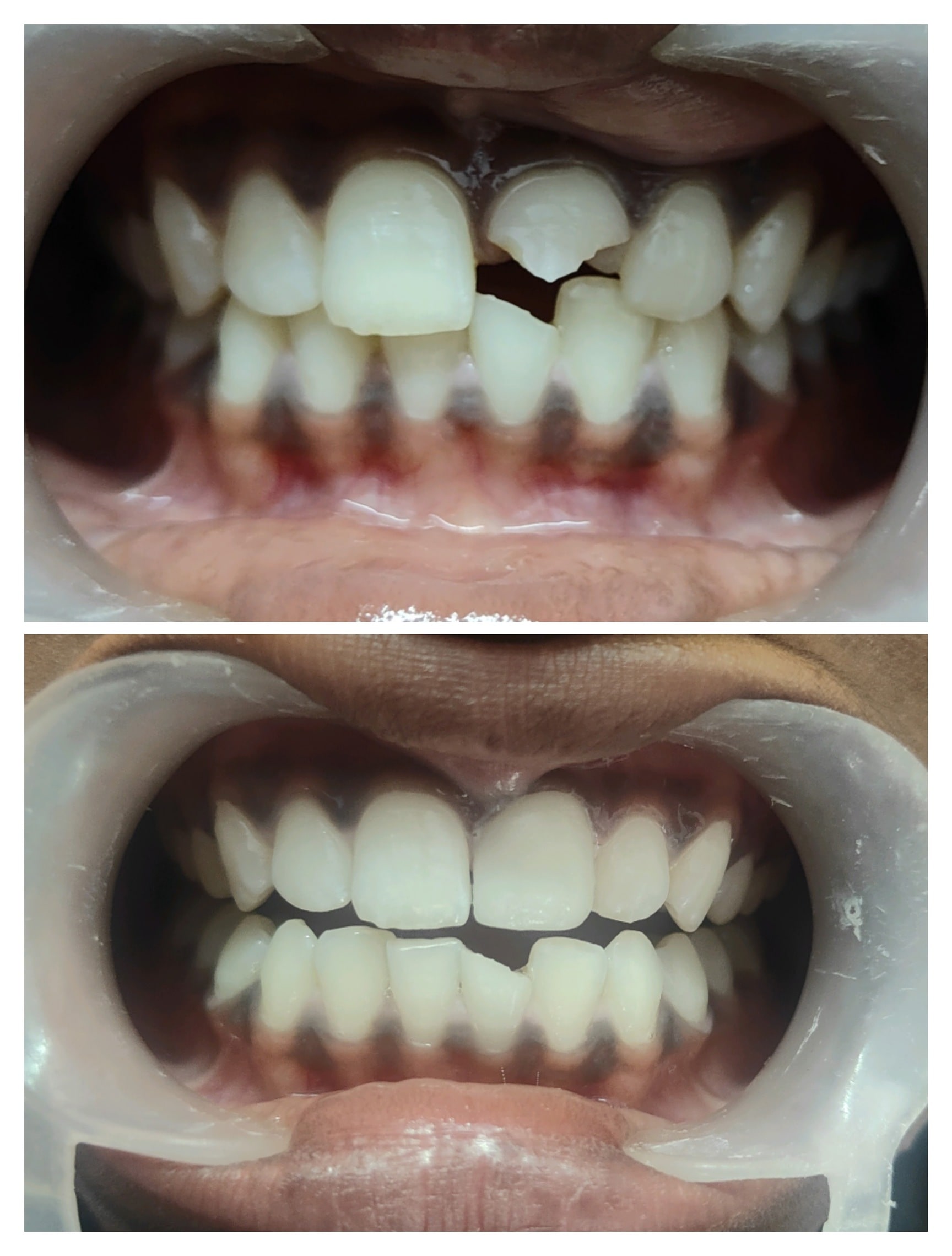 The Ultimate Deal On top dental clinic in Dwarka