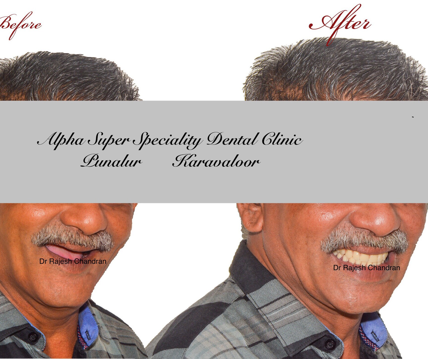 Alpha Super Speciality Dental Clinic in Karavaloor,Kollam Book