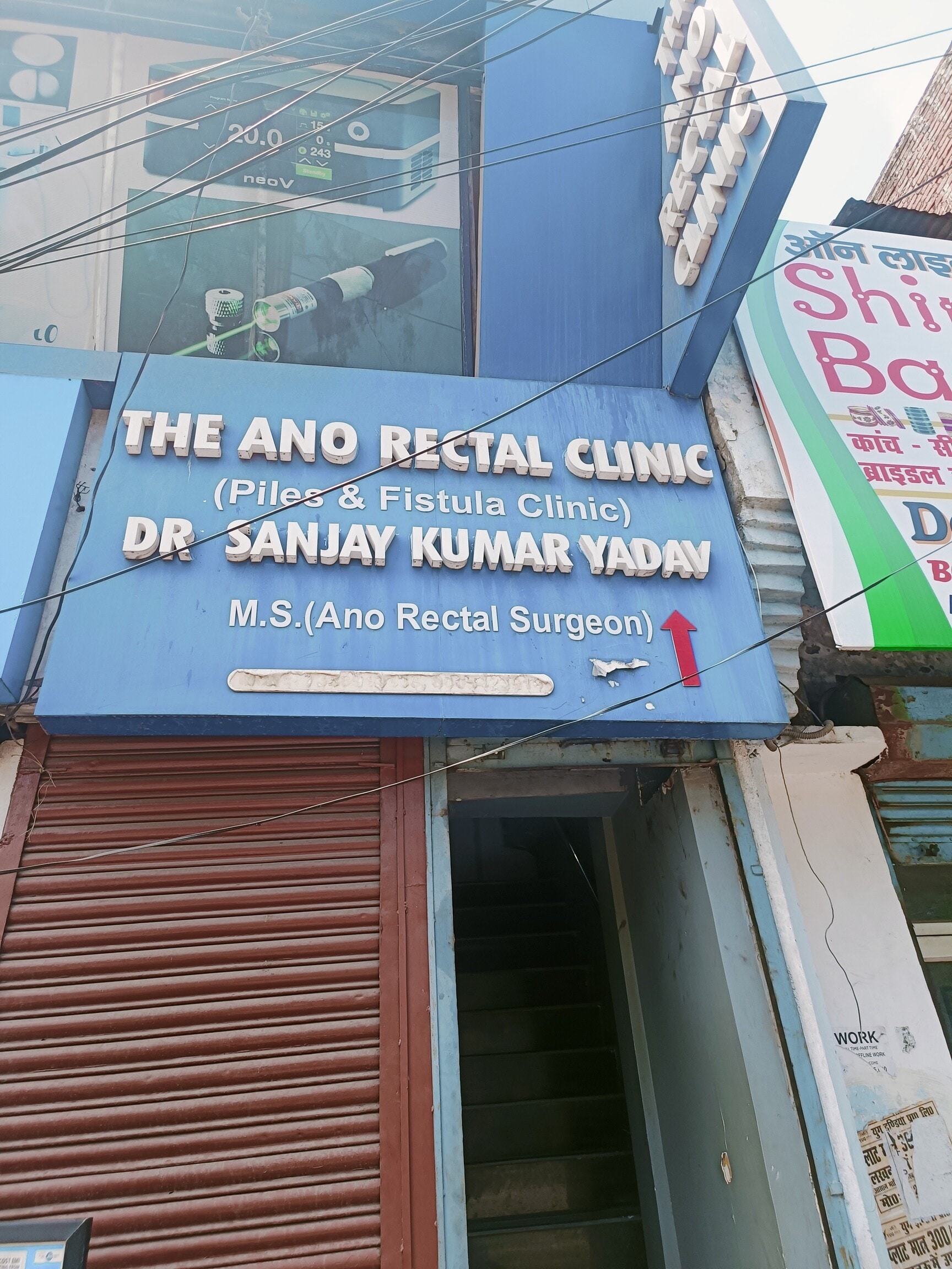 Anal Girl Union City