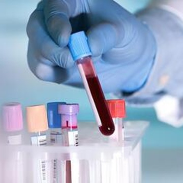 Lab Detail Image
