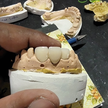 The #1 top-rated dental implant center in Dwarka Mistake, Plus 7 More Lessons