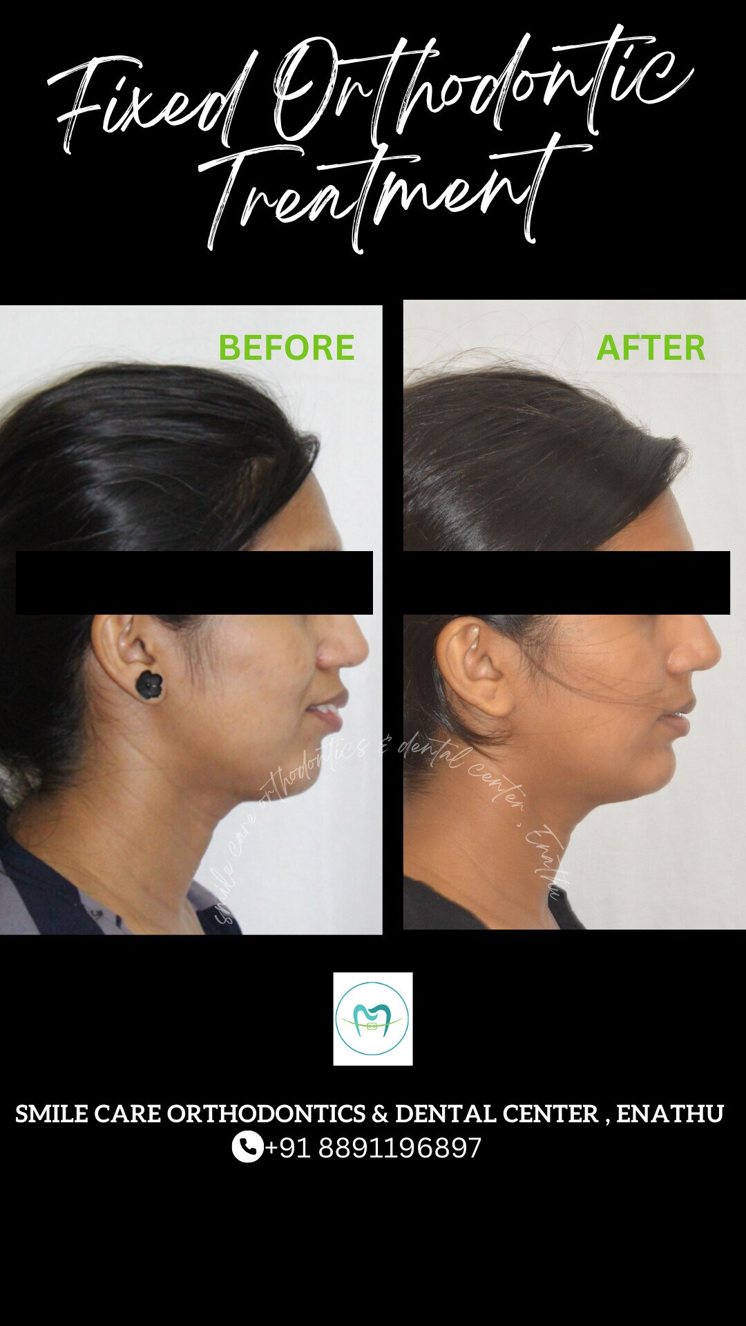 Smile Care Orthodontics And Dental Center in Enathu,Pathanamthitta Best Dental Clinics in