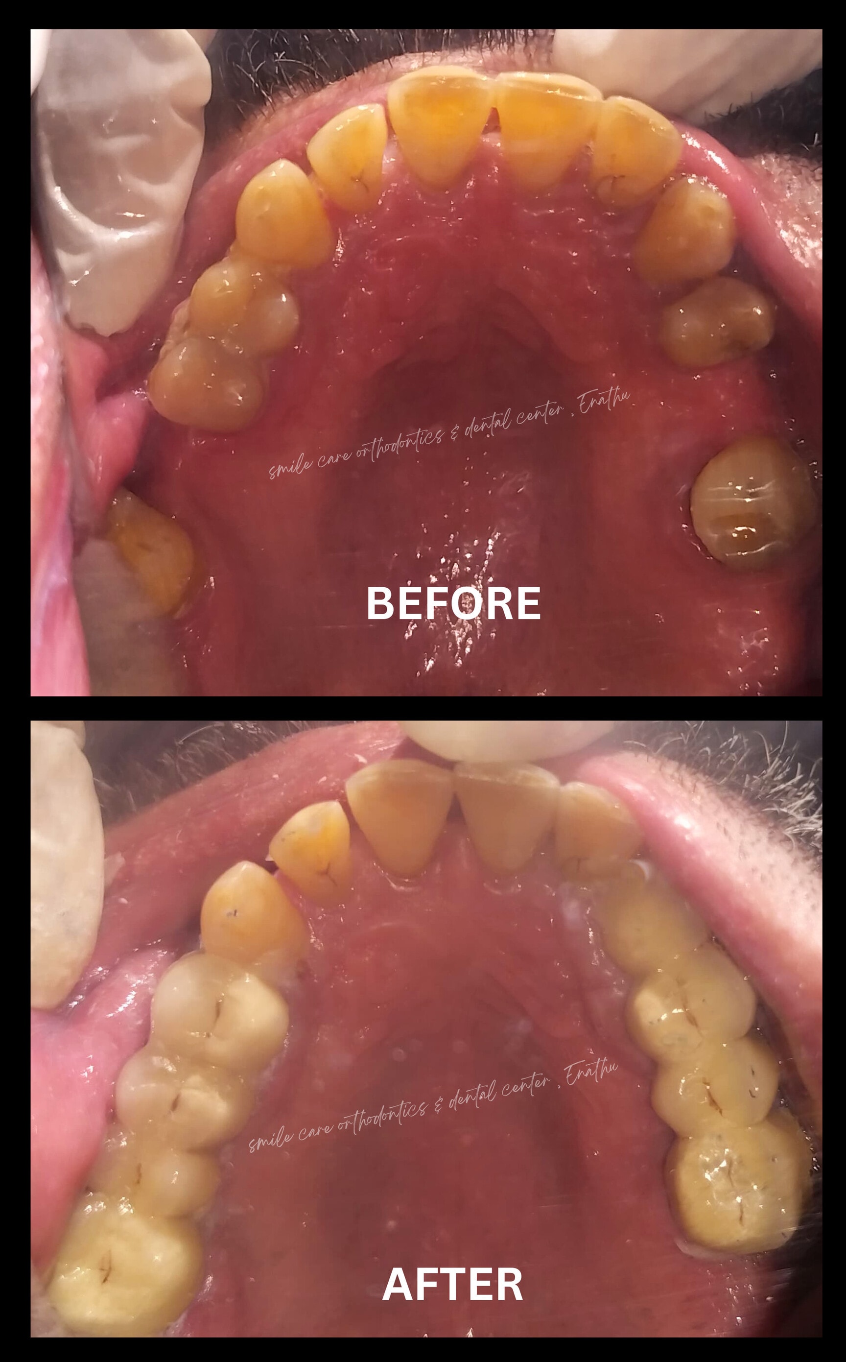 Smile Care Orthodontics And Dental Center in Enathu,Pathanamthitta Best Dental Clinics in