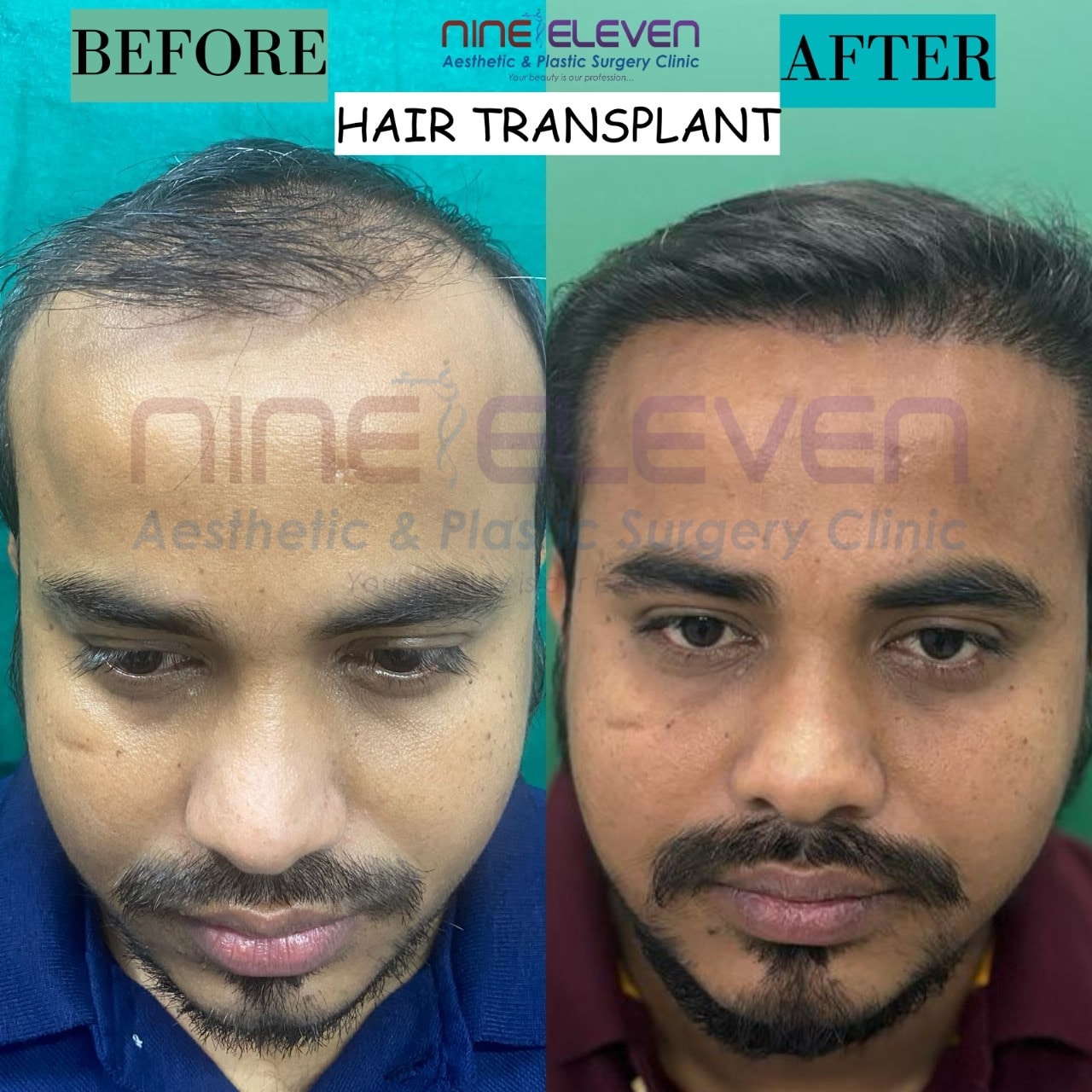 aesthetic plastic surgery of the east