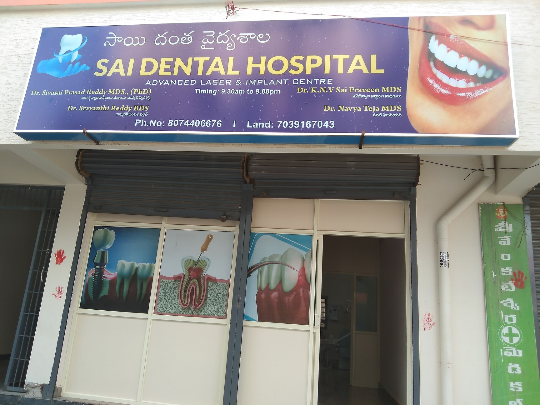 7 Things I Would Do If I'd Start Again permanent tooth prosthesis A Simple Plan For permanent tooth prosthesis