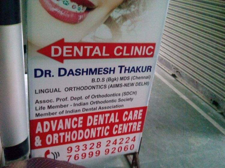 ☺︎ Paano Mag-Switch ng Account sa Advance Server ng MLBB | TikTok